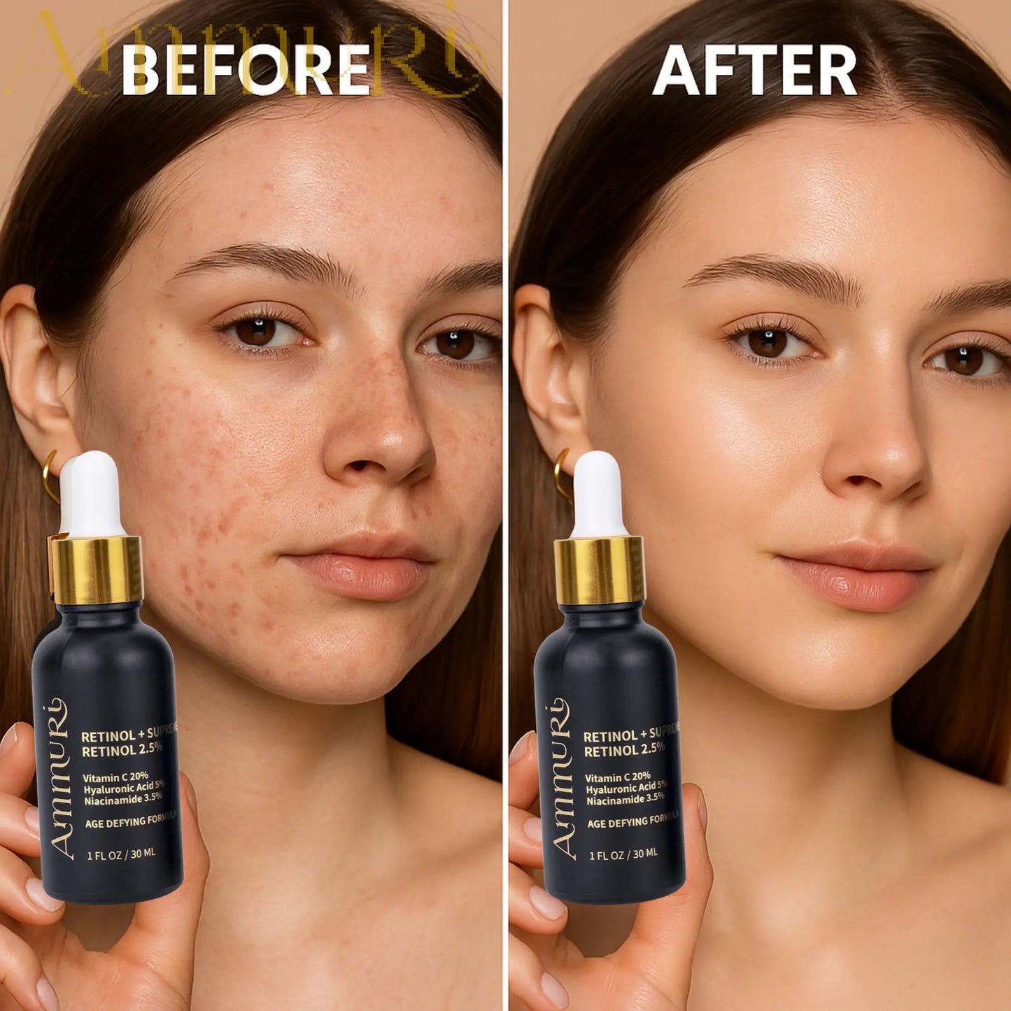 Ammuri 2.5% Retinol Serum - Gentle Anti-Aging Treatment