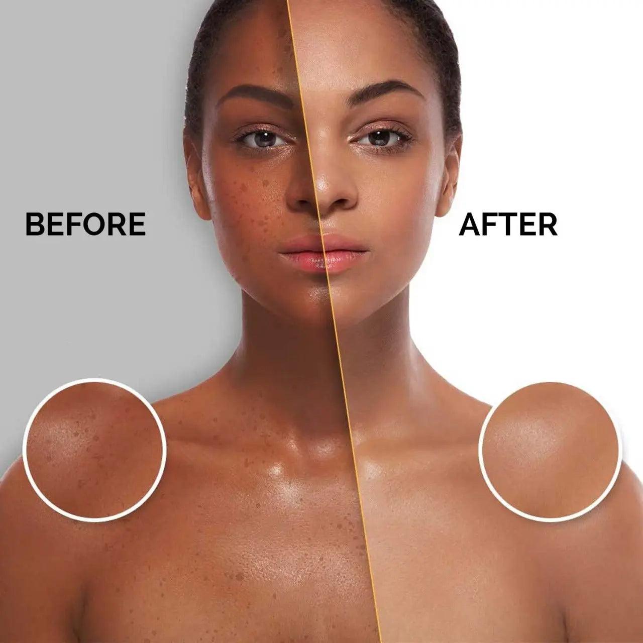 Ammuri Premium Whitening Serum 30ml β Kojic Acid + Tranexamic Acid | Dark Spot & Pigmentation Corrector