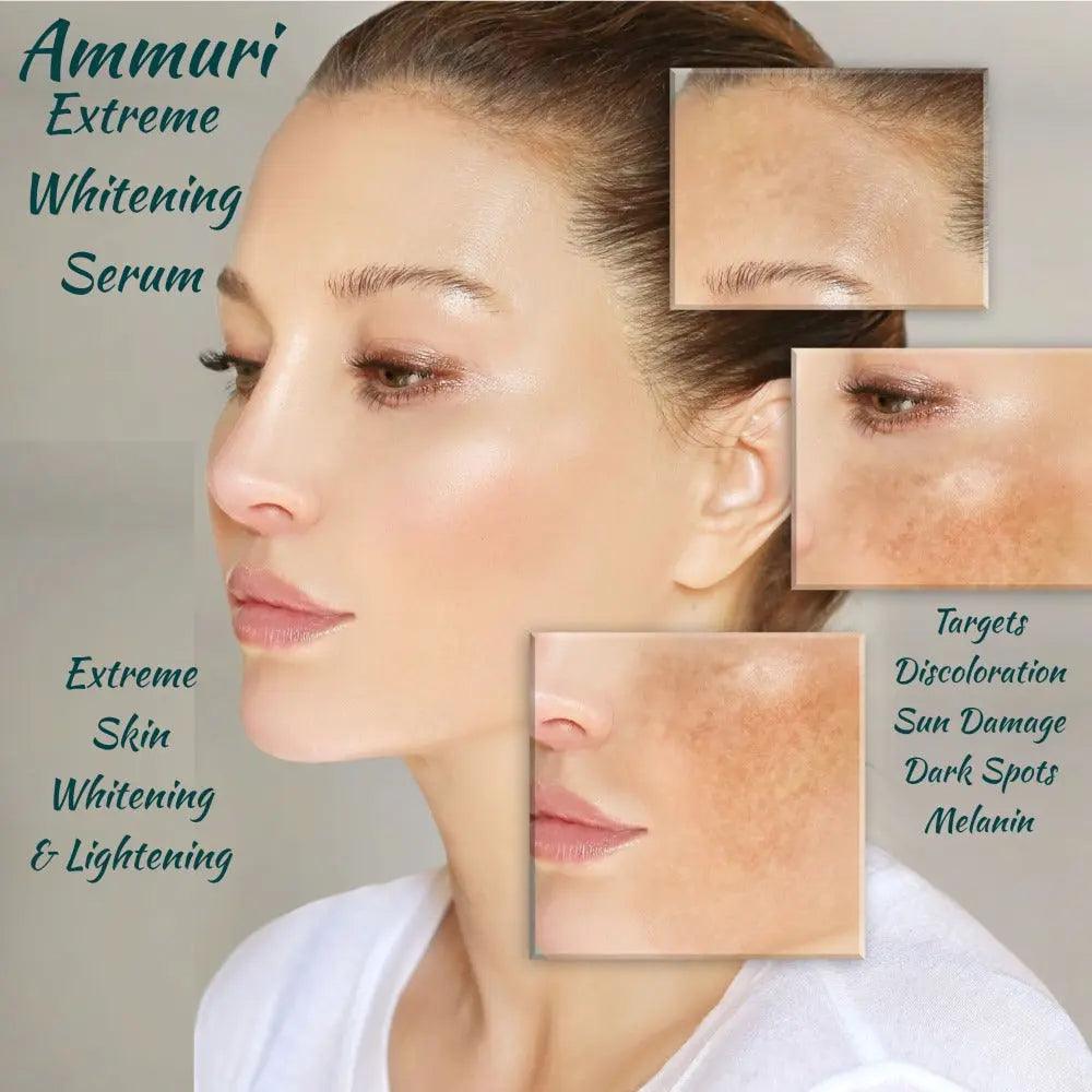 Ammuri Premium Whitening Serum 30ml β Kojic Acid + Tranexamic Acid | Dark Spot & Pigmentation Corrector