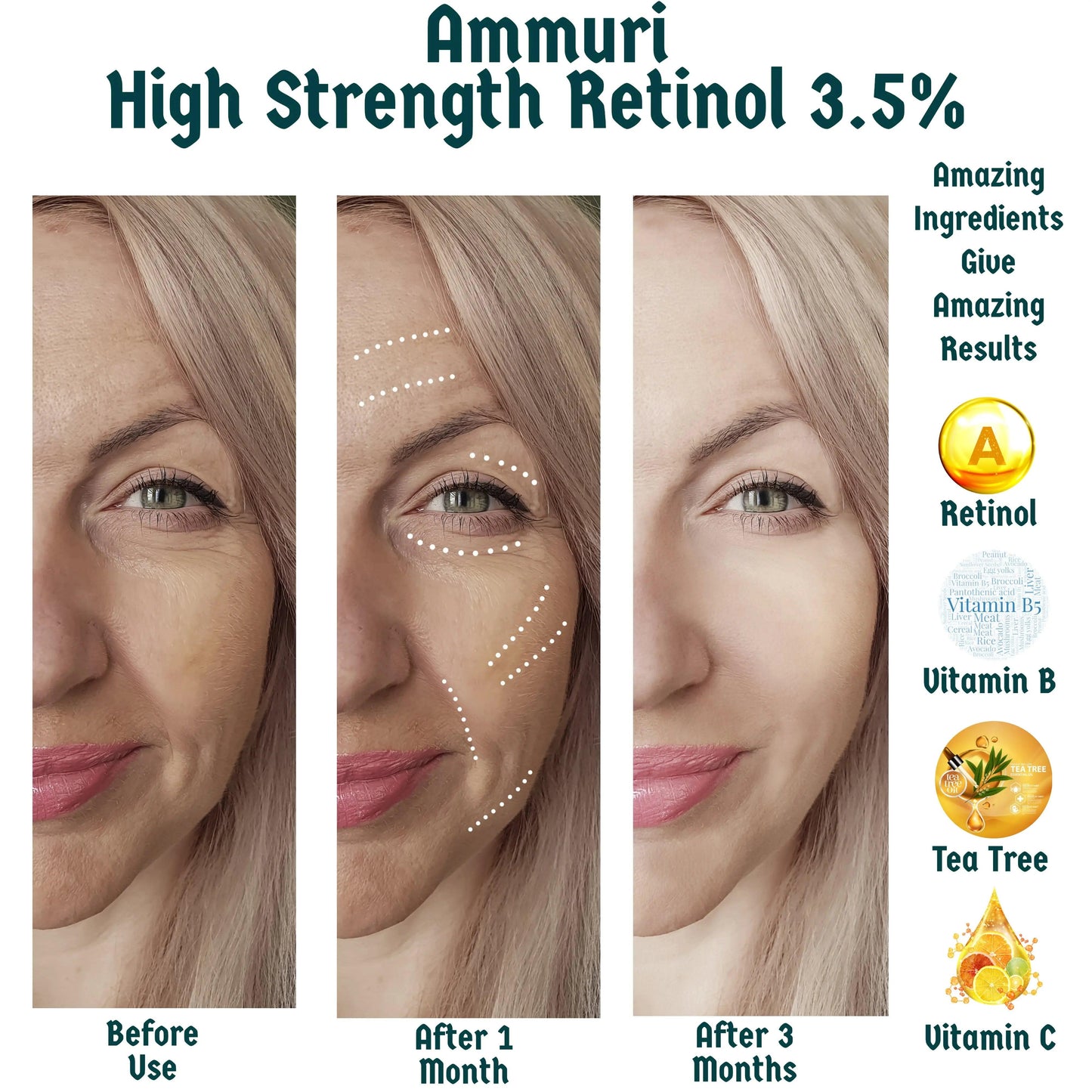 Ammuri Powerful Retinol Serum for Radiant Skin 3.5% Retinol