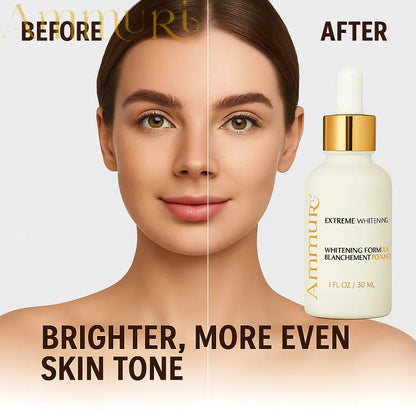 Ammuri Premium Whitening Serum 30ml – Kojic Acid + Tranexamic Acid | Dark Spot & Pigmentation Corrector