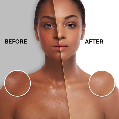 Ammuri Premium Whitening Serum 30ml – Kojic Acid + Tranexamic Acid | Dark Spot & Pigmentation Corrector